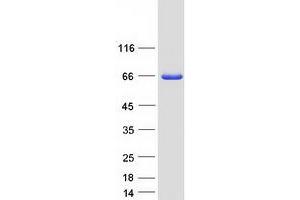 Validation with Western Blot