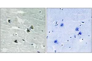 Immunohistochemistry analysis of paraffin-embedded human brain, using MER/SKY (Phospho-Tyr749/681) Antibody. (MER/SKY (AA 716-765), (pTyr749) anticorps)