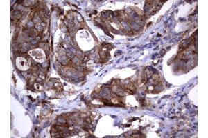 Image no. 2 for anti-Sialidase 1 (Lysosomal Sialidase) (NEU1) (AA 48-315) antibody (ABIN1491548)