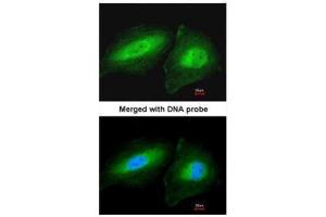 ICC/IF Image Immunofluorescence analysis of paraformaldehyde-fixed HeLa, using CCDC83, antibody at 1:200 dilution.