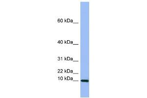 WB Suggested Anti-SEMG1 Antibody Titration:  0. (SEMG1 anticorps  (Middle Region))