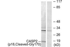 Western Blotting (WB) image for anti-Caspase 2, Apoptosis-Related Cysteine Peptidase (CASP2) (Cleaved-Gly170) antibody (ABIN1853490) (Caspase 2 anticorps  (Cleaved-Gly170))