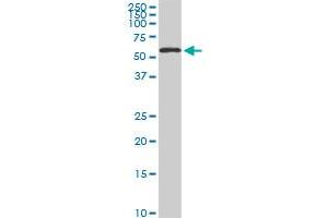 HDAC1 monoclonal antibody (M02), clone 3E1 Western Blot analysis of HDAC1 expression in Hela S3 NE . (HDAC1 anticorps  (AA 1-482))