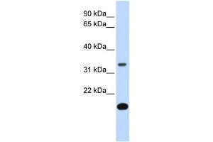 WB Suggested Anti-FST Antibody Titration:  0. (Follistatin anticorps  (Middle Region))