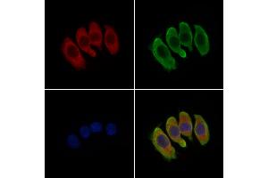 ABIN6259687 and ABIN6279169 staining Hela cells by IF/ICC.