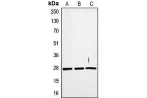 Western blot analysis of TWEAK expression in SKNSH (A), WI38 (B), HuvEc (C) whole cell lysates. (TWEAK anticorps  (Center))