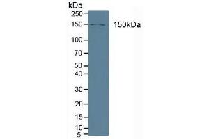 Detection of PLCb3 in Human A431 cells using Polyclonal Antibody to Phospholipase C Beta 3, Phosphoinositide Specific (PLCb3) (Phospholipase C beta 3, Phosphoinositide Specific (AA 318-468) anticorps)
