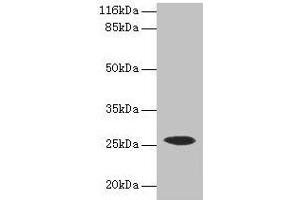 Western blot All lanes: CSHL1 antibody at 2 μg/mL + Human placenta tissue Secondary Goat polyclonal to rabbit IgG at 1/10000 dilution Predicted band size: 26, 23, 16, 15 kDa Observed band size: 26 kDa (CSHL1 anticorps  (AA 1-128))