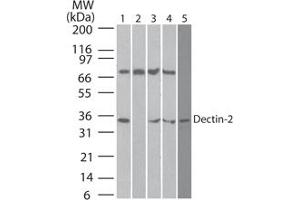 Image no. 2 for anti-C-Type Lectin Domain Family 6, Member A (CLEC6A) (AA 75-125) antibody (ABIN959984) (C-Type Lectin Domain Family 6, Member A (CLEC6A) (AA 75-125) anticorps)