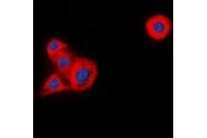 Immunofluorescent analysis of LCK staining in HeLa cells. (LCK anticorps)