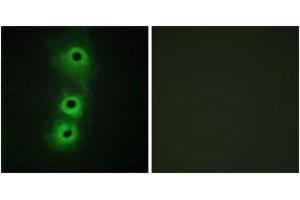Immunofluorescence analysis of COS7 cells, using CDH8 Antibody. (Cadherin 8 anticorps  (AA 491-540))