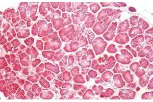 Human, Pancreas: Formalin-Fixed Paraffin-Embedded (FFPE)