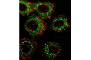 Fluorescent image of A549 cell stained with FADS2 Antibody (N-term) (ABIN656230 and ABIN2845545)/SA110322AN. (FADS2 anticorps  (N-Term))