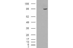HEK293 overexpressing SMEK1 and probed with ABIN2560023 (mock transfection in first lane). (SMEK1 anticorps  (Internal Region))