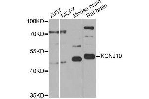 Western blot analysis of extracts of various cell lines, using KCNJ10 Antibody (ABIN6003558) at 1/1000 dilution. (KCNJ10 anticorps)