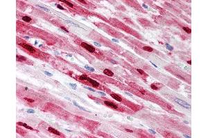 Anti-PLA2G2A antibody IHC of human heart.