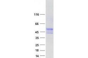 Validation with Western Blot