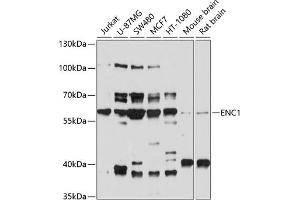 Western blot analysis of extracts of various cell lines, using ENC1 antibody (ABIN6130834, ABIN6140166, ABIN6140167 and ABIN6214438) at 1:1000 dilution. (ENC1 anticorps  (AA 1-270))