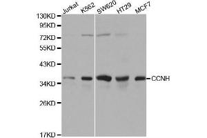 Western blot analysis of extracts of various cell lines, using CCNH antibody. (Cyclin H anticorps  (AA 1-323))