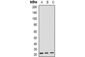 Western blot analysis of SAR1B expression in HEK293T (A), Hela (B), RAW264. (SAR1B anticorps)