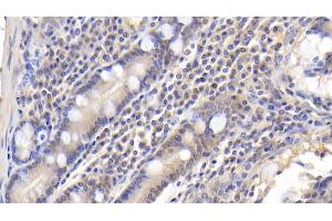 anti-Cyclin-Dependent Kinase 2 Associated Protein 1 (CDK2AP1) (AA 1-115) antibody