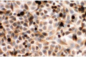 ICC testing of CYPOR antibody and human placenta cells (POR anticorps  (C-Term))