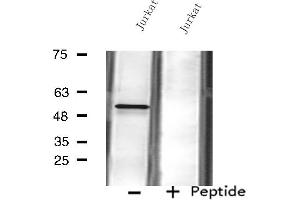 Western blot analysis of extracts from Jurkat cells using FKRP antibody. (FKRP anticorps  (N-Term))
