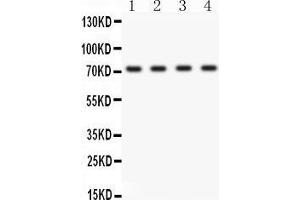 Anti- ABCG2 Picoband antibody, Western blotting All lanes: Anti ABCG2  at 0.
