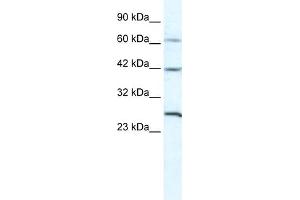 WB Suggested Anti-GJC1 Antibody Titration:  5. (GJC1 anticorps  (N-Term))