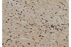ABIN6263047 and ABIN6276556 at 1/100 staining Rat heart tissue by IHC-P. (MAD1L1 anticorps  (N-Term))