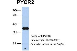 Host: Rabbit Target Name: PYCR2 Sample Type: 293T Antibody Dilution: 1. (PYCR2 anticorps  (C-Term))