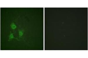 Immunofluorescence analysis of A549 cells, using PKA CAT (Phospho-Thr197) Antibody. (PKA CAT (AA 166-215), (pThr198) anticorps)