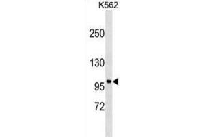 Western Blotting (WB) image for anti-Protein Phosphatase 1, Regulatory (Inhibitor) Subunit 9A (PPP1R9A) antibody (ABIN3000500) (PPP1R9A anticorps)