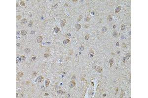 Immunohistochemistry of paraffin-embedded Mouse brain using NME1 Polyclonal Antibody at dilution of 1:200 (40x lens). (NME1 anticorps)