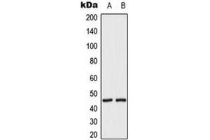 Western blot analysis of MKK2 (pT394) expression in HeLa UV-treated (A), HepG2 UV-treated (B) whole cell lysates. (MEK2 anticorps  (C-Term, pSer394))