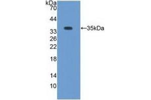 Detection of Recombinant PKCb1, Rabbit using Polyclonal Antibody to Protein Kinase C Beta 1 (PKCb1) (Pkc beta 1 anticorps  (AA 342-600))
