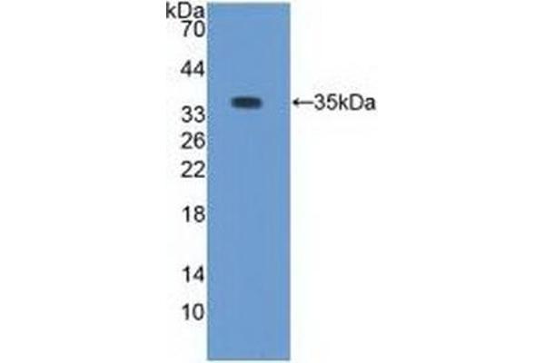Pkc beta 1 anticorps  (AA 342-600)
