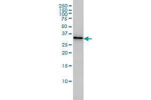 PDCL3 monoclonal antibody (M01), clone 1F10 Western Blot analysis of PDCL3 expression in Jurkat . (PDCL3 anticorps  (AA 1-239))