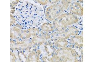 Immunohistochemistry of paraffin-embedded Rat kidney using DCP2 Polyclonal Antibody at dilution of 1:100 (40x lens).