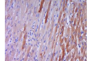 Paraformaldehyde-fixed, paraffin embedded rat heart muscle Antigen retrieval by boiling in sodium citrate buffer (pH6. (Prepro-Endothelin-1 (AA 16-110) anticorps)