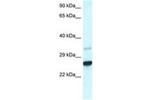 Image no. 1 for anti-Caudal Type Homeobox 1 (CDX1) (AA 195-244) antibody (ABIN6747429) (CDX1 anticorps  (AA 195-244))