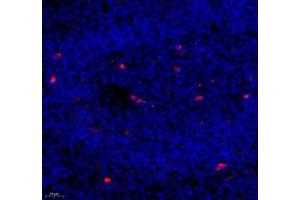 Immunofluorescence of paraffin embedded mouse spleen using c-caspase3 (ABIN7073336) at dilution of 1:500 (400x lens)
