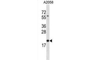 BLOC1S3 Antibody (C-term) (ABIN1881114 and ABIN2838858) western blot analysis in  cell line lysates (35 μg/lane). (BLOC1S3 anticorps  (C-Term))