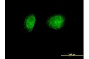 Immunofluorescence of purified MaxPab antibody to SNX1 on HeLa cell.
