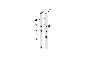 All lanes : Anti-NOP2 Antibody (N-Term) at 1:2000 dilution Lane 1: K562 whole cell lysate Lane 2: U-2OS whole cell lysate Lysates/proteins at 20 μg per lane. (Nucleolar Protein 1 (NOL1) (AA 9-43) anticorps)