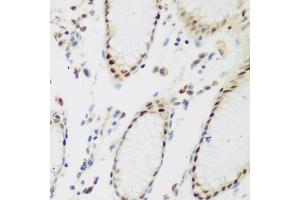 Immunohistochemistry of paraffin-embedded human stomach using PPAN antibody (ABIN6133157, ABIN6145994, ABIN6145996 and ABIN6223238) at dilution of 1:200 (40x lens).