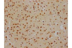 IHC image of ABIN7127538 diluted at 1:100 and staining in paraffin-embedded human brain tissue performed on a Leica BondTM system. (Recombinant HDAC2 anticorps)