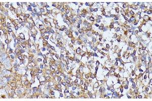 Immunohistochemistry of paraffin-embedded Human tonsil using STK24 Polyclonal Antibody at dilution of 1:100 (40x lens). (STK24 anticorps)