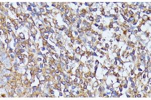 Immunohistochemistry of paraffin-embedded Human tonsil using STK24 Polyclonal Antibody at dilution of 1:100 (40x lens). (STK24 anticorps)