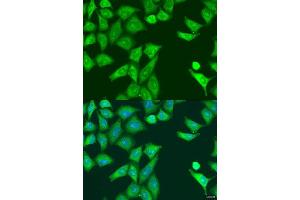 Immunofluorescence analysis of U2OS cells using EIF2AK2 antibody.
